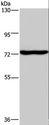 KCND1 / Kv4.1 Antibody - Western blot analysis of Mouse brain tissue, using KCND1 Polyclonal Antibody at dilution of 1:400.