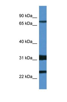 KCND1 / Kv4.1 Antibody - KCND1 / Kv4.1 antibody Western blot of Mouse Spleen lysate. Antibody concentration 1 ug/ml. This image was taken for the unconjugated form of this product. Other forms have not been tested.