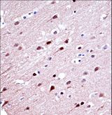 KCND2 / Kv4.2 Antibody - KCND2 Antibody immunohistochemistry of formalin-fixed and paraffin-embedded human brain tissue followed by peroxidase-conjugated secondary antibody and DAB staining.