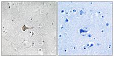 KCND2 / Kv4.2 Antibody - Peptide - + Immunohistochemistry analysis of paraffin-embedded human brain tissue using Kv4.2/KCND2 antibody.