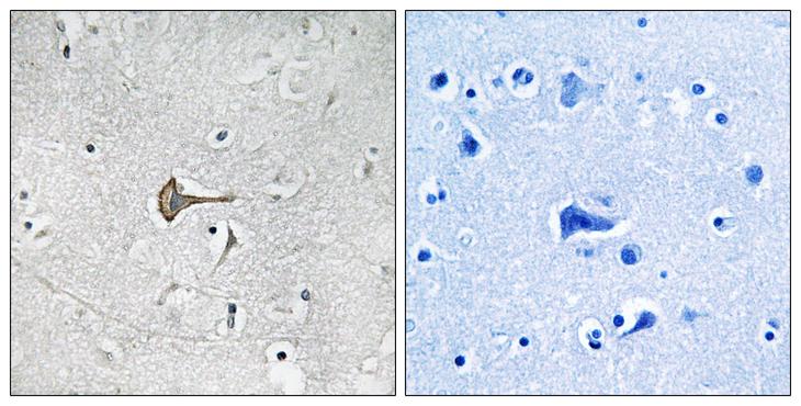 KCND2 / Kv4.2 Antibody - Peptide - + Immunohistochemistry analysis of paraffin-embedded human brain tissue using Kv4.2/KCND2 antibody.