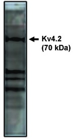 KCND2 / Kv4.2 Antibody - Western blot of Kv4.2 antibody on rat brain lysate.