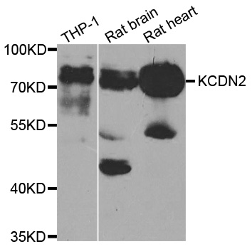 KCND2 / Kv4.2 Antibody - Western blot analysis of extracts of various cell lines.