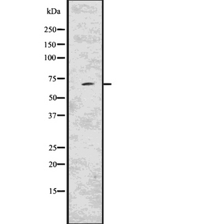 KCND2 / Kv4.2 Antibody - Western blot analysis of KCND2 using MCF-7 whole lysates.