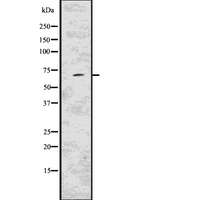 KCND2 / Kv4.2 Antibody - Western blot analysis of KCND2 using MCF-7 whole lysates.