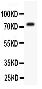 KCND3 / Kv4.3 Antibody - Kv4.3 antibody Western blot. All lanes: Anti Kv4.3 at 0.5 ug/ml. WB: Mouse Brain Tissue Lysate at 50 ug. Predicted band size: 73 kD. Observed band size: 73 kD.