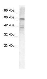 KCND3 / Kv4.3 Antibody - HepG2 Cell Lysate.  This image was taken for the unconjugated form of this product. Other forms have not been tested.