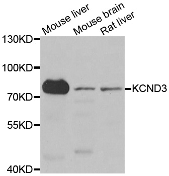 KCND3 / Kv4.3 Antibody - Western blot analysis of extracts of various cell lines.