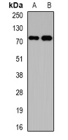 KCND3 / Kv4.3 Antibody - Western blot analysis of Kv4.3 expression in mouse brain (A); rat liver (B) whole cell lysates.