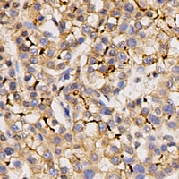 KCND3 / Kv4.3 Antibody - Immunohistochemical analysis of Kv4.3 staining in human pancreas formalin fixed paraffin embedded tissue section. The section was pre-treated using heat mediated antigen retrieval with sodium citrate buffer (pH 6.0). The section was then incubated with the antibody at room temperature and detected using an HRP conjugated compact polymer system. DAB was used as the chromogen. The section was then counterstained with hematoxylin and mounted with DPX.