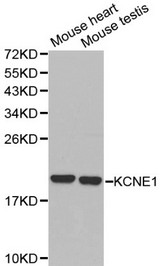 KCNE1 / MinK Antibody - Western blot of KCNE1 pAb in extracts from mouse heart and testis tissues.