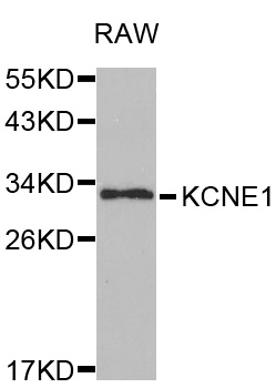 KCNE1 / MinK Antibody - Western blot analysis of extracts of RAW cells.