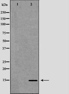 KCNE1 / MinK Antibody - Western blot analysis of mouse heart tissue using KCNE1 antibody. The lane on the left is treated with the antigen-specific peptide.