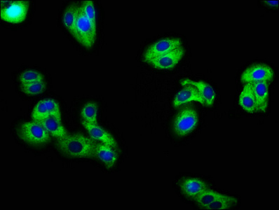 KCNE3 Antibody - Immunofluorescence staining of HepG2 cells with KCNE3 Antibody at 1:66, counter-stained with DAPI. The cells were fixed in 4% formaldehyde, permeabilized using 0.2% Triton X-100 and blocked in 10% normal Goat Serum. The cells were then incubated with the antibody overnight at 4°C. The secondary antibody was Alexa Fluor 488-congugated AffiniPure Goat Anti-Rabbit IgG(H+L).