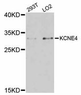 KCNE4 Antibody - Western blot analysis of extracts of various cell lines, using KCNE4 antibody at 1:3000 dilution. The secondary antibody used was an HRP Goat Anti-Rabbit IgG (H+L) at 1:10000 dilution. Lysates were loaded 25ug per lane and 3% nonfat dry milk in TBST was used for blocking. An ECL Kit was used for detection and the exposure time was 90s.