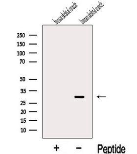 KCNE4 Antibody - Western blot analysis of extracts of human skeletal muscle tissue using KCNE4 antibody. The lane on the left was treated with blocking peptide.