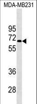 KCNF1 / KCNF Antibody - KCNF1 Antibody western blot of MDA-MB231 cell line lysates (35 ug/lane). The KCNF1 antibody detected the KCNF1 protein (arrow).