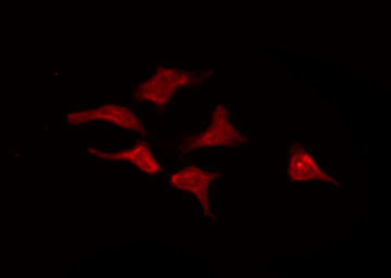 KCNF1 / KCNF Antibody - Staining HeLa cells by IF/ICC. The samples were fixed with PFA and permeabilized in 0.1% Triton X-100, then blocked in 10% serum for 45 min at 25°C. The primary antibody was diluted at 1:200 and incubated with the sample for 1 hour at 37°C. An Alexa Fluor 594 conjugated goat anti-rabbit IgG (H+L) Ab, diluted at 1/600, was used as the secondary antibody.