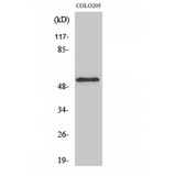 KCNG2 Antibody - Western blot of KCNG2 antibody