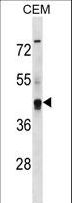 KCNG2 Antibody - KCNG2 Antibody western blot of CEM cell line lysates (35 ug/lane). The KCNG2 antibody detected the KCNG2 protein (arrow).