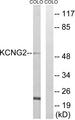 KCNG2 Antibody - Western blot analysis of extracts from COLO cells, using KCNG2 antibody.