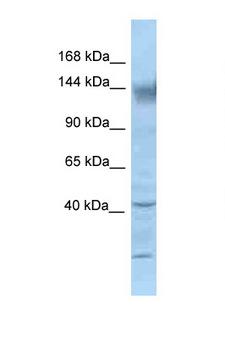 KCNH2 / HERG Antibody - KCNH2 / Kv11.1 antibody Western blot of Mouse Kidney lysate. Antibody concentration 1 ug/ml.  This image was taken for the unconjugated form of this product. Other forms have not been tested.