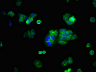 KCNH2 / HERG Antibody - Immunofluorescent analysis of HepG2 cells at a dilution of 1:100 and Alexa Fluor 488-congugated AffiniPure Goat Anti-Rabbit IgG(H+L)