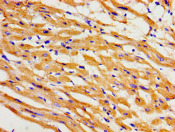 KCNH2 / HERG Antibody - Immunohistochemistry image of paraffin-embedded human heart tissue at a dilution of 1:100