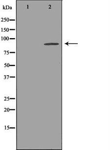 KCNH2 / HERG Antibody - Western blot analysis of extracts of mouse brain tissue lysate using KCNH2 antibody. The lane on the left is treated with the antigen-specific peptide.