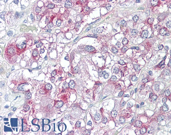 KCNH3 / Kv12.2 Antibody - Anti-KCNH3 antibody IHC of human adrenal. Immunohistochemistry of formalin-fixed, paraffin-embedded tissue after heat-induced antigen retrieval. Antibody dilution 5-10 ug/ml. This image was taken for the unconjugated form of this product. Other forms have not been tested.