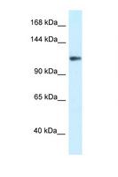 KCNH3 / Kv12.2 Antibody - KCNH3 / Kv12.2 antibody Western blot of COL0205 Cell lysate. Antibody concentration 1 ug/ml.  This image was taken for the unconjugated form of this product. Other forms have not been tested.