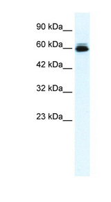 KCNH5 / Kv10.2 Antibody - KCNH5 / Kv10.2 antibody Western blot of HepG2 cell lysate. This image was taken for the unconjugated form of this product. Other forms have not been tested.