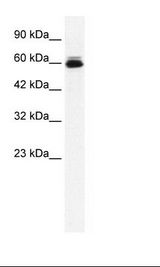 KCNH5 / Kv10.2 Antibody - HepG2 Cell Lysate.  This image was taken for the unconjugated form of this product. Other forms have not been tested.