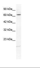 KCNH6 / Kv11.2 / ERG2 Antibody - Jurkat Cell Lysate.  This image was taken for the unconjugated form of this product. Other forms have not been tested.