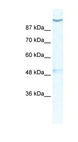 KCNH6 / Kv11.2 / ERG2 Antibody - KCNH6 / Kv11.2 antibody Western blot of HepG2 cell lysate. This image was taken for the unconjugated form of this product. Other forms have not been tested.