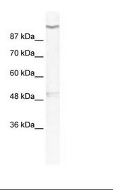 KCNH6 / Kv11.2 / ERG2 Antibody - HepG2 Cell Lysate.  This image was taken for the unconjugated form of this product. Other forms have not been tested.