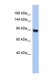 KCNH6 / Kv11.2 / ERG2 Antibody - KCNH6 / Kv11.2 antibody Western blot of HT1080 cell lysate. This image was taken for the unconjugated form of this product. Other forms have not been tested.