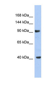 KCNH6 / Kv11.2 / ERG2 Antibody - KCNH6 / Kv11.2 antibody Western blot of NCI-H226 cell lysate. This image was taken for the unconjugated form of this product. Other forms have not been tested.