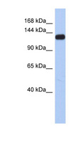 KCNH7 / ERG3 Antibody - KCNH7 / Kv11.3 antibody Western blot of Fetal Small Intestine lysate. This image was taken for the unconjugated form of this product. Other forms have not been tested.
