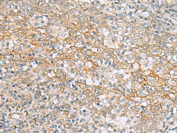 KCNH7 / ERG3 Antibody - Immunohistochemistry of paraffin-embedded Human tonsil tissue  using KCNH7 Polyclonal Antibody at dilution of 1:60(×200)
