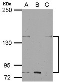KCNH7 / ERG3 Antibody - Sample (30 ug of whole cell lysate) A: H1299 B: HCT116 C: MCF-7 5% SDS PAGE KCNH7 / Kv11.3 antibody diluted at 1:500