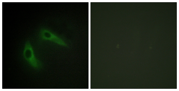KCNIP1 / KCHIP1 Antibody - Immunofluorescence analysis of HeLa cells, using KCIP1 Antibody. The picture on the right is blocked with the synthesized peptide.