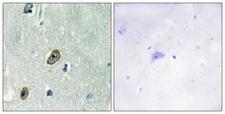 KCNIP1 / KCHIP1 Antibody - Immunohistochemistry analysis of paraffin-embedded human brain tissue, using KCIP1 Antibody. The picture on the right is blocked with the synthesized peptide.