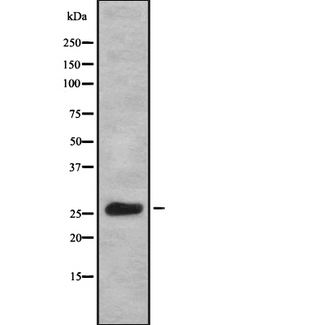 KCNIP1 / KCHIP1 Antibody - Western blot analysis of KCIP1 using COLO205 whole cells lysates