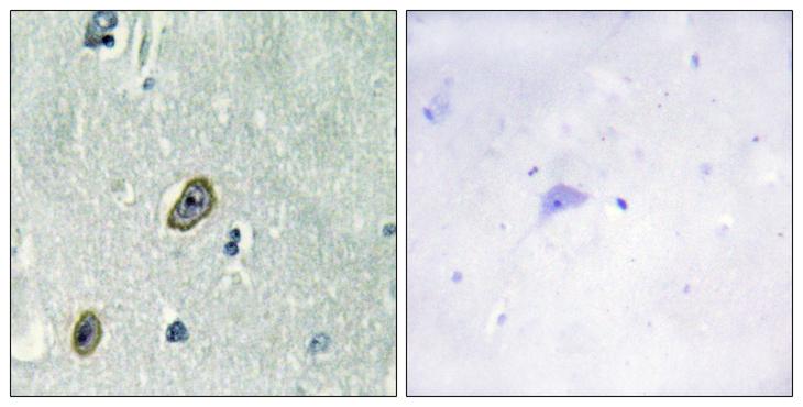 KCNIP1 / KCHIP1 Antibody - Peptide - + Immunohistochemistry analysis of paraffin-embedded human brain tissue, using KCIP1 antibody.