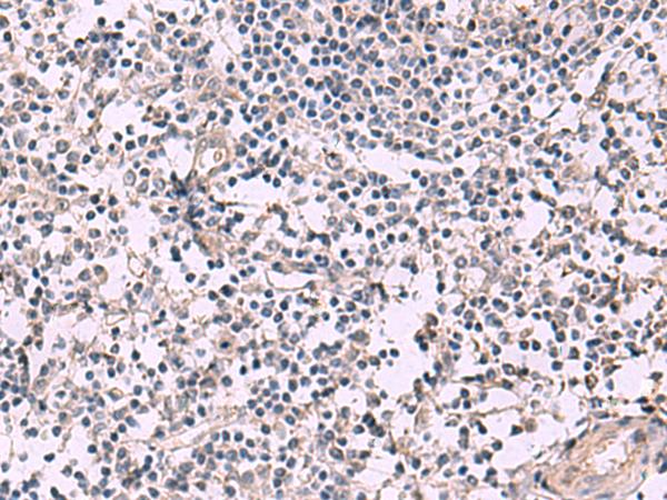 KCNIP1 / KCHIP1 Antibody - Immunohistochemistry of paraffin-embedded Human tonsil tissue  using KCNIP1 Polyclonal Antibody at dilution of 1:40(×200)