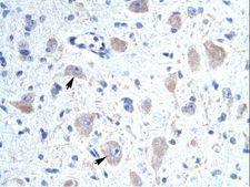 KCNIP1 / KCHIP1 Antibody - KCNIP1 antibody ARP35246_T100-NP_055407-KCNIP1 (Kv channel interacting protein 1) Antibody was used in IHC to stain formalin-fixed, paraffin-embedded human brain.  This image was taken for the unconjugated form of this product. Other forms have not been tested.