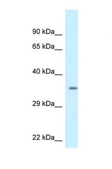 KCNIP2 / KCHIP2 Antibody - KCNIP2 / KCHIP2 antibody Western blot of 293T Cell lysate. Antibody concentration 1 ug/ml.  This image was taken for the unconjugated form of this product. Other forms have not been tested.