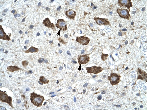 KCNIP2 / KCHIP2 Antibody - KCNIP2 / KCHIP2 antibody ARP35497_P050-NP_775285-KCNIP2 (Kv channel interacting protein 2) Antibody was used in IHC to stain formalin-fixed, paraffin-embedded human brain.  This image was taken for the unconjugated form of this product. Other forms have not been tested.