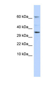 KCNIP2 / KCHIP2 Antibody - KCNIP2 / KCHIP2 antibody western blot of Human Fetal Liver lysate.  This image was taken for the unconjugated form of this product. Other forms have not been tested.